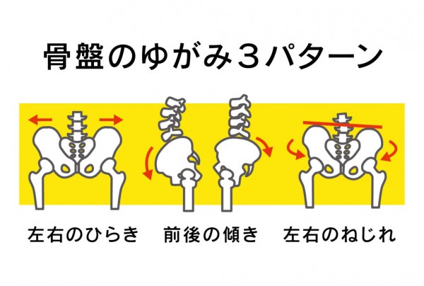 骨盤の歪みチェック☆