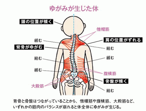 姿勢の崩れが首や肩に与える影響とは？骨盤と胸椎ケアでコリ解消